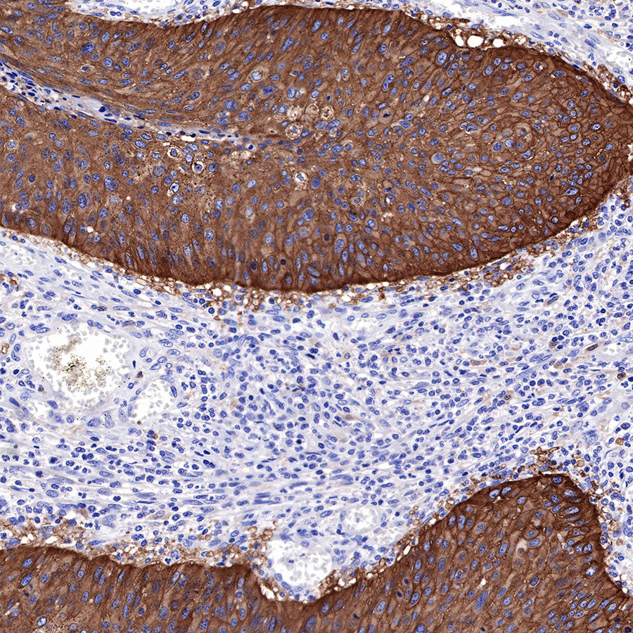 EGFR Recombinant Rabbit mAb (SDT-R110)