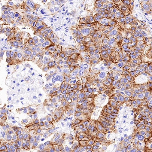 Claudin 3+Claudin 9 Recombinant Rabbit mAb (SDT-1452-69)
