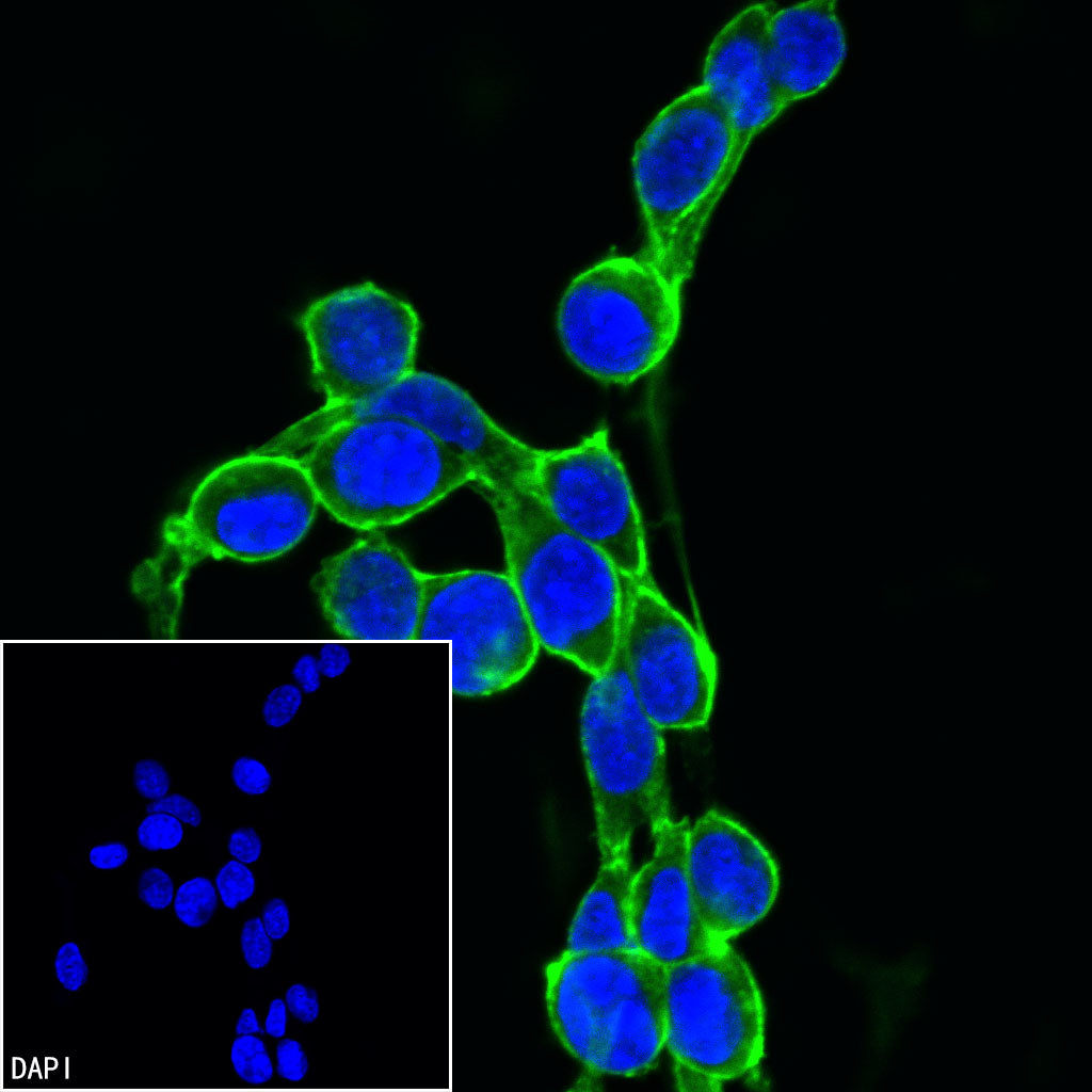 β-actin Rabbit mAb (SDT-R015)