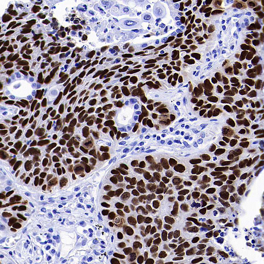 SOX2 Recombinant Rabbit mAb (S-5000)