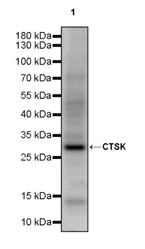 CTSK Recombinant Rabbit mAb (S-1370-278)