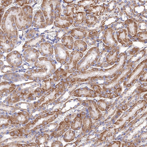 Bad Recombinant Rabbit mAb (S-976-26)