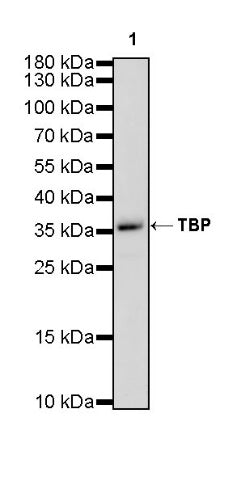 TBP Recombinant Rabbit mAb (S-886-57)