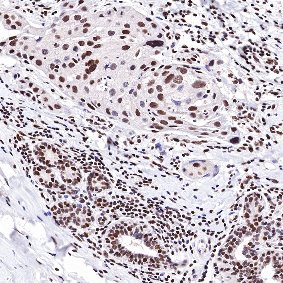 HDAC1 Recombinant Rabbit mAb (SDT-310-72)