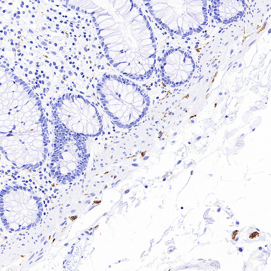 PGP9.5 Recombinant Mouse mAb (S-6071)