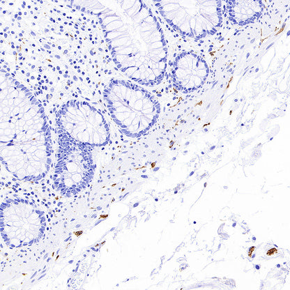 PGP9.5 Recombinant Mouse mAb (S-6071)