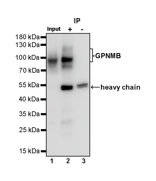 GPNMB Recombinant Rabbit mAb (S-491-6)