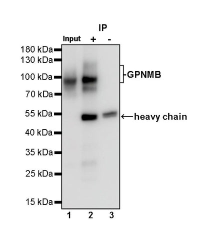 GPNMB Recombinant Rabbit mAb (S-491-6)