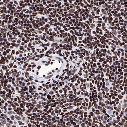 NuMA Recombinant Rabbit mAb (SDT-474-241)