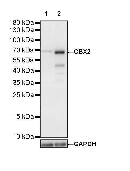 CBX2 Recombinant Rabbit mAb (S-4357-7)