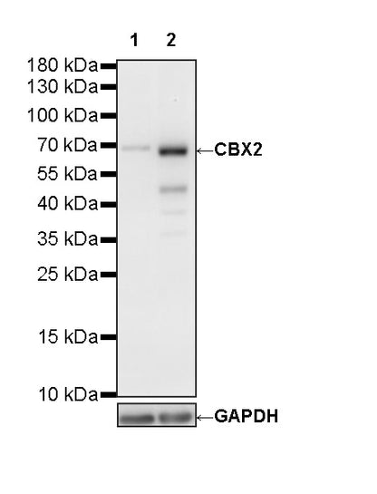 CBX2 Recombinant Rabbit mAb (S-4357-7)