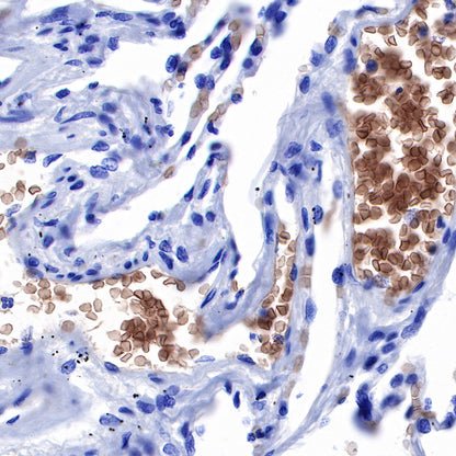 S-RMab® GLUT1 Recombinant Rabbit mAb (SDT-047-53)