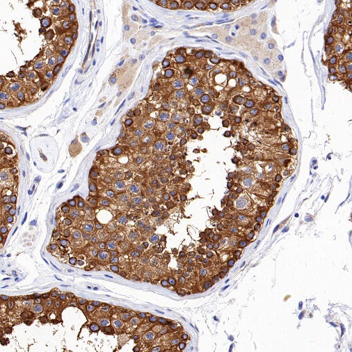 Beta IV Tubulin Recombinant Rabbit mAb (S-1572-30)