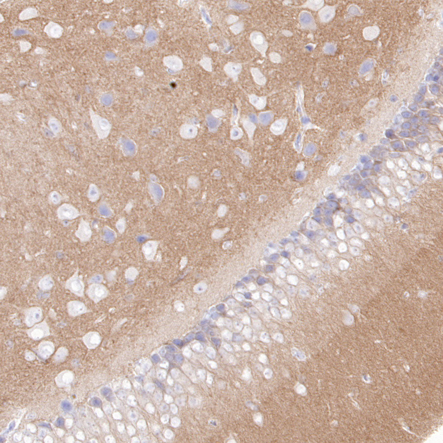 CaV2.3 (CACNA1E) Recombinant Rabbit mAb (S-3244-59)