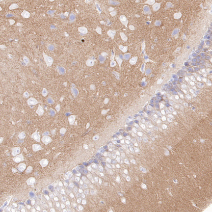 CaV2.3 (CACNA1E) Recombinant Rabbit mAb (S-3244-59)