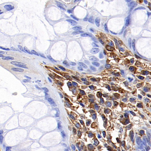 Ferritin Light Chain Recombinant Rabbit mAb (S-1879-19)