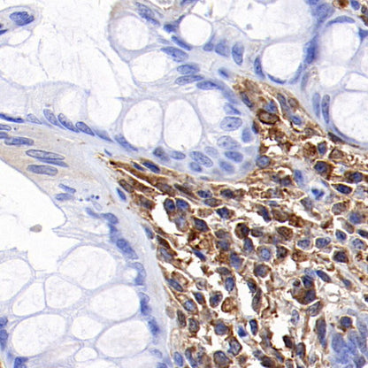 Ferritin Light Chain Recombinant Rabbit mAb (S-1879-19)