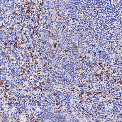 CD42b Recombinant Rabbit mAb (SDT-R147)