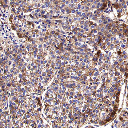 PTK7 Recombinant Rabbit mAb (SDT-2432-156)