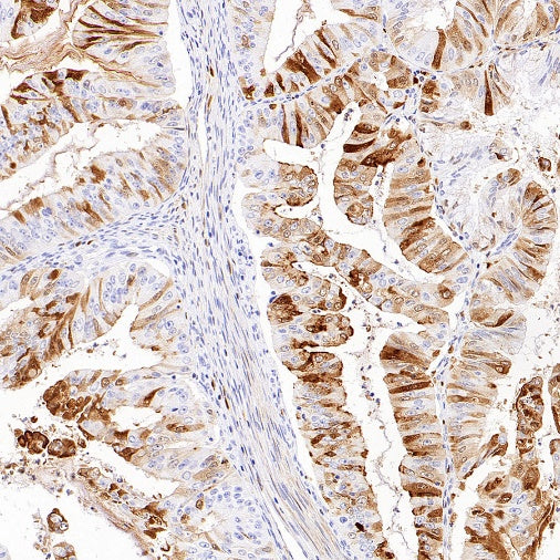 MMP7 Recombinant Rabbit mAb (S-1628-25)