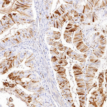 MMP7 Recombinant Rabbit mAb (S-1628-25)