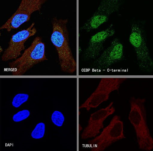 CEBP Beta (C-terminal) Recombinant Rabbit mAb (S-773-48)