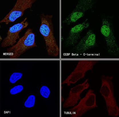 CEBP Beta (C-terminal) Recombinant Rabbit mAb (S-773-48)
