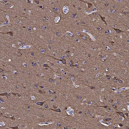 Human Cytoplasmic Marker Recombinant Mouse mAb (SDT-2921)