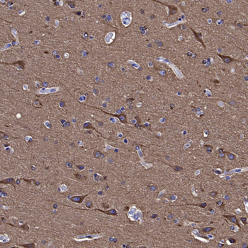 Human Cytoplasmic Marker Recombinant Mouse mAb (SDT-2921)