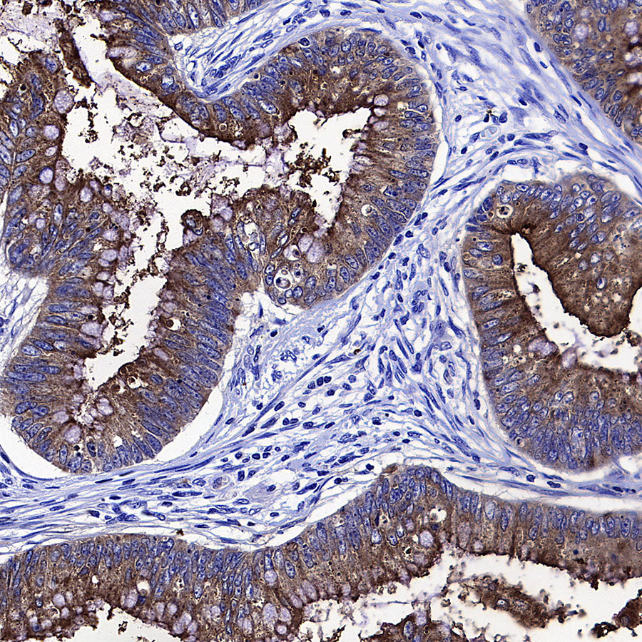 CEA Recombinant Rabbit mAb (SDT-098-63)