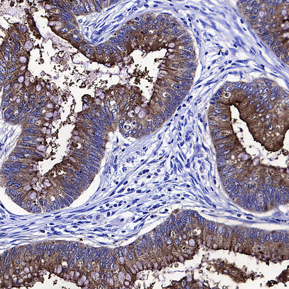 CEA Recombinant Rabbit mAb (SDT-098-63)