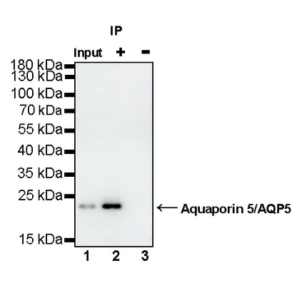 Aquaporin 5/AQP5 Recombinant Rabbit mAb (S-1610-43)