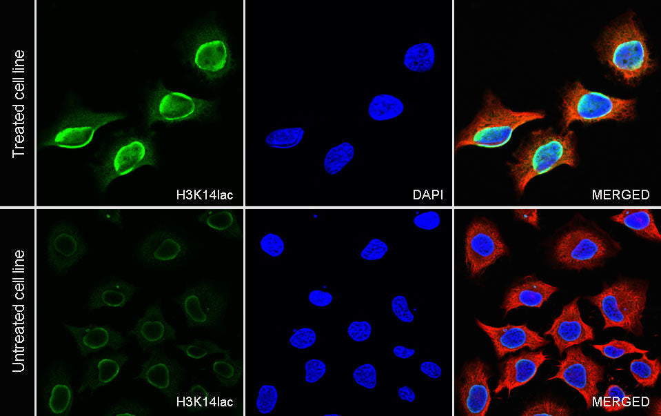 L-Lactyl Lysine Rabbit mAb
