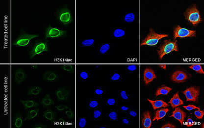 L-Lactyl Lysine Rabbit mAb