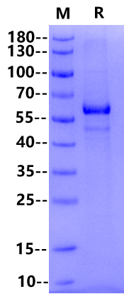 IL-27 His Tag Protein, Human