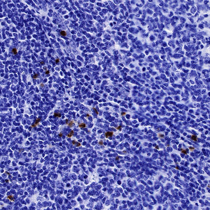 NGAL Recombinant Rabbit mAb (S-473-22)