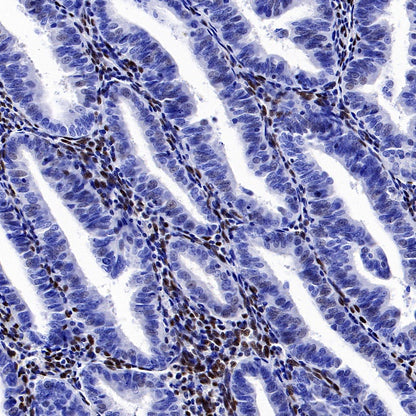 ZEB1 Recombinant Rabbit mAb