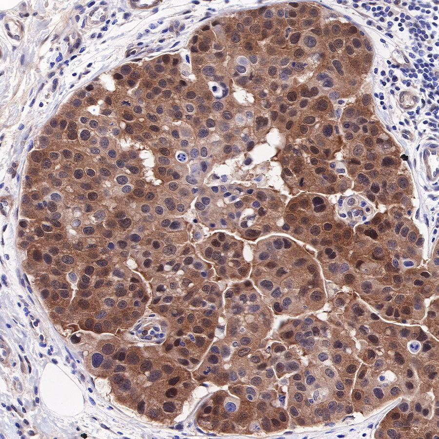 Akt (pan) Recombinant Rabbit mAb (SDT-R169)