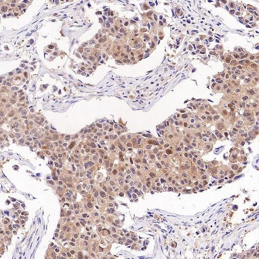 PRMT5 Recombinant Rabbit mAb (S-2336-126)