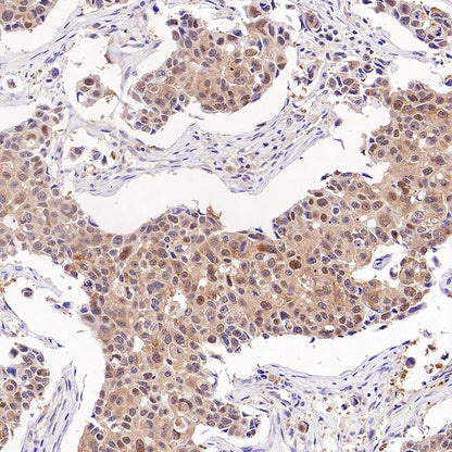 PRMT5 Recombinant Rabbit mAb (S-2336-126)