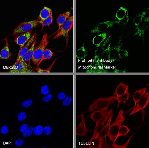 Prohibitin Recombinant Rabbit mAb (S-2679-7)