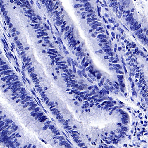 PMEL/Melanoma gp100 Recombinant Rabbit mAb (SDT-434-70)