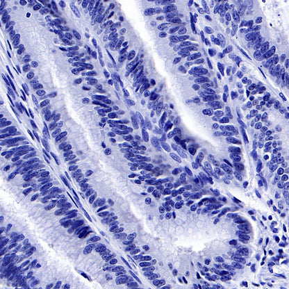 PMEL/Melanoma gp100 Recombinant Rabbit mAb (SDT-434-70)
