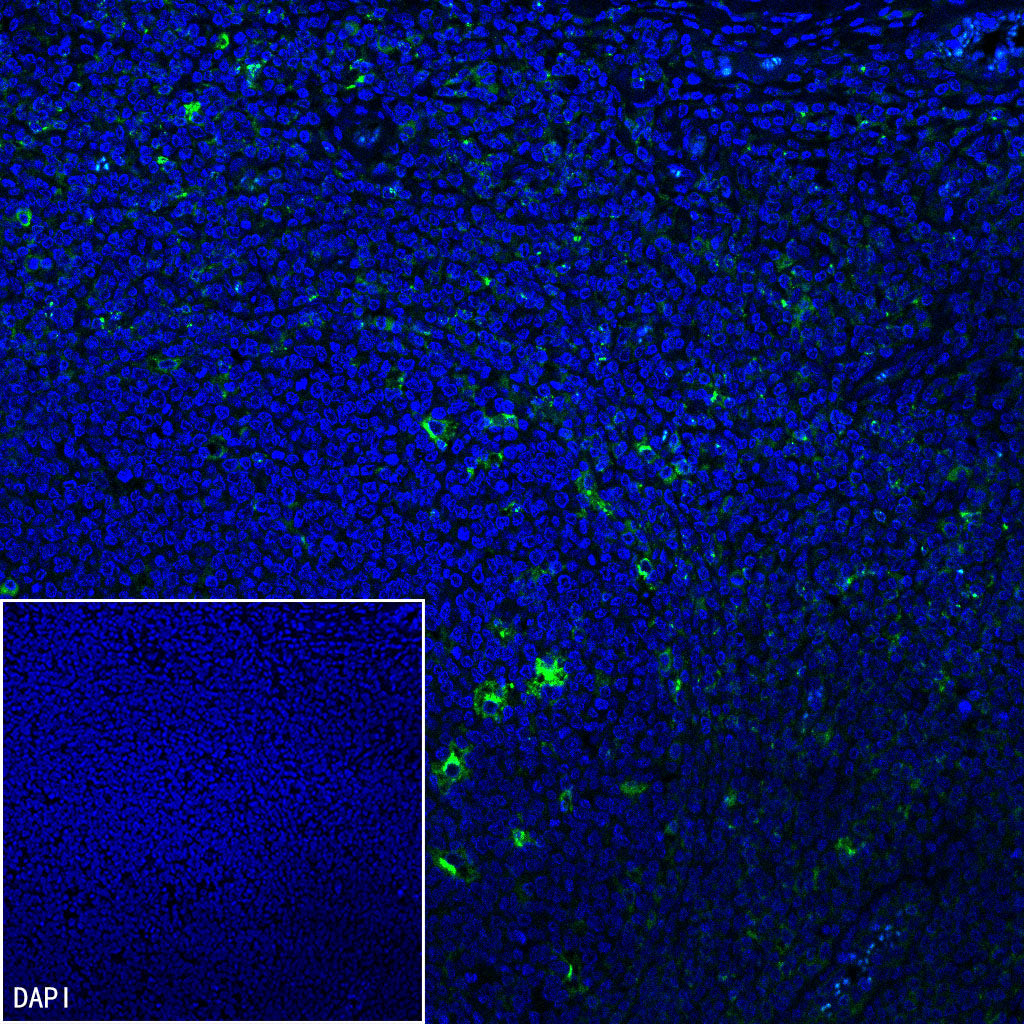 CCL18 Recombinant Rabbit mAb (S-2788-25)