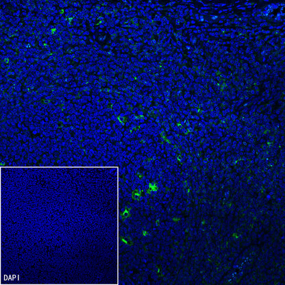 CCL18 Recombinant Rabbit mAb (S-2788-25)
