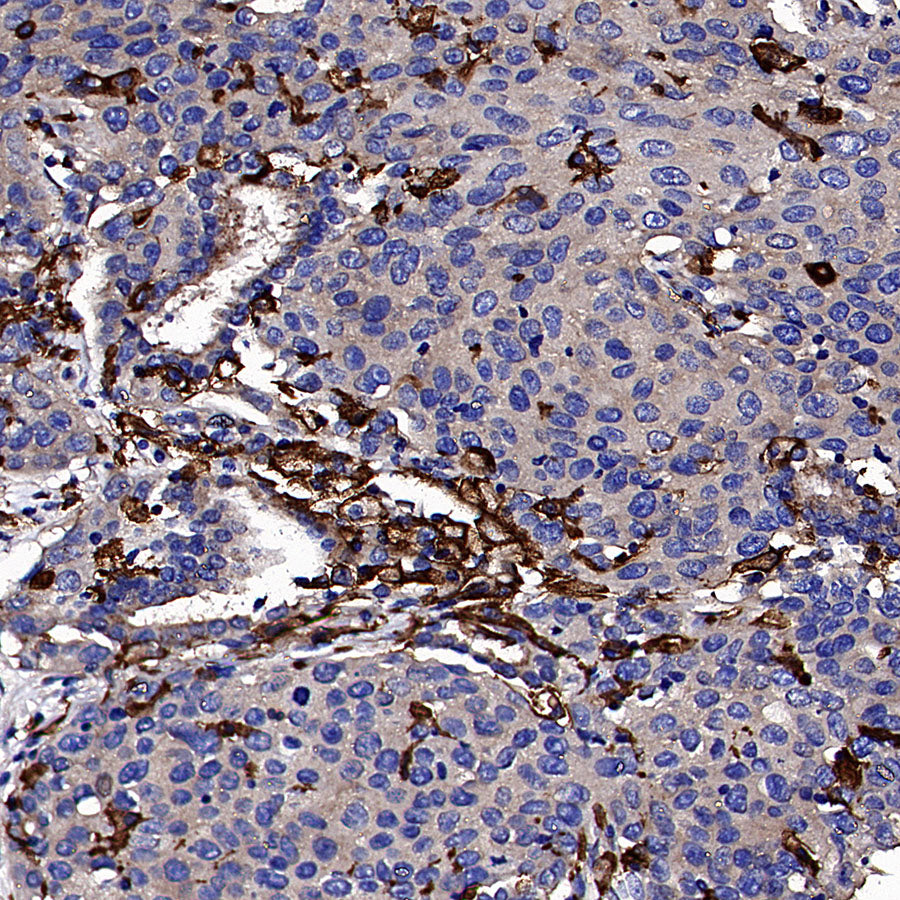CD64 Recombinant Mouse mAb (S-5504)