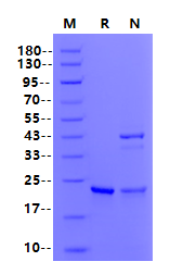 SKP1 His Tag Protein, Human