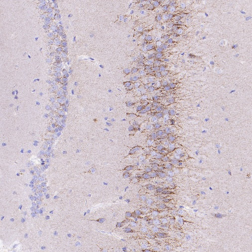 SORT1 Recombinant Rabbit mAb (S-2233-47)