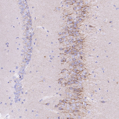 SORT1 Recombinant Rabbit mAb (S-2233-47)