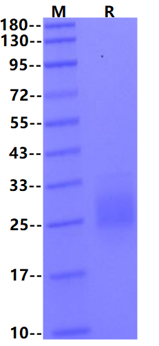 Biotinylated CTLA-4/CD152 His & Avi Tag Protein, Mouse
